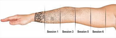 For a permanent tattoo removal procedure, laser treatment is the best option. Laser Tattoo Removal Treatment In Mk London Mk Aesthetics