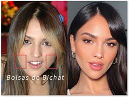 El costo de la bichectomía ha de incluir las consultas previas a la cirugía. Bichectomia Que Es Y Cuanto Cuesta Iconica Servicios Medicos