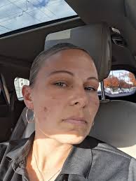 What products can get rid of dark spots?