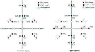 Acupuncture Styles In Current Practice Springerlink