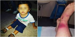 Ia juga sama seperti septicemia. Jangkitan Kuman Dalam Darah Bakteri Streptococcus Bisa Sebabkan Penyakit Apa Saja Ini Daftarnya Sepsis Merupakan Satu Keadaan Di Mana Jangkitan Kuman Sudah Merebak Ke Dalam Darah