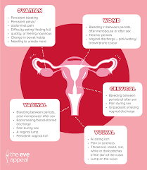 The others are cervical and uterine cancer. Vagina Museum On Twitter Ovarian Cancer Is The Second Most Common Gynae Cancer And Over 7 000 New Cases Are Confirmed In The Uk Every Year It Is Also One Of The Most