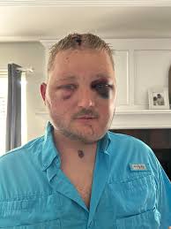 Prayers for Aaron's Health and Well-being