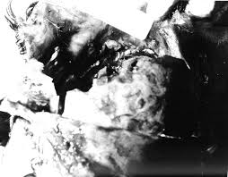 Résultat de recherche d'images pour "jfk autopsy photos"