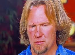 What happened to dunleavy”s face?