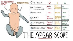Image result for APGAR Score