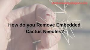 In general, cacti require lots of very bright light to be healthy. How Do You Remove Embedded Cactus Needles Industrial And Personal Safety Products From Onlinesafetydepot Com