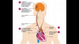 К a 1 b a g r. De Que Viene La Trombosis Cerebral