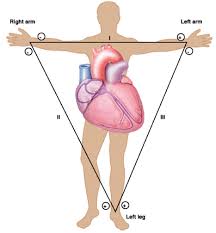 how to read ecg basic common charts phartoonz