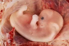 Embarazo Ectopico Sintomas Tratamiento Causas Y Mas Madres Hoy