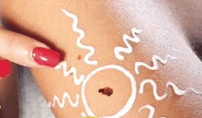 Vantage oncology is a network of cancer treatment facilities that provide personalized care in a community setting. Check Your Skin It S Easy And Necessary