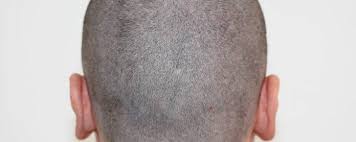 A hurricane and marketing woes couldn't keep these persistent franchisees down. Vademecum Post Trapianto Di Capelli Fue Firstduty E Mayhemag