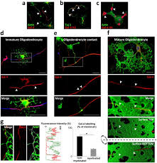 Route details of 02295 sanghamitra exp from ksr bengaluru to danapur. Neurons Define Non Myelinated Axon Segments By The Regulation Of Galectin 4 Containing Axon Membrane Domains Scientific Reports