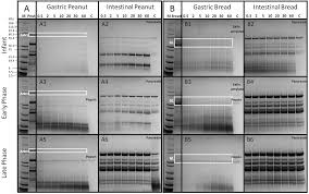 Convert mixed numbers and fractions to percents. Human Gastrointestinal Conditions Affect In Vitro Digestibility Of Peanut And Bread Proteins Food Function Rsc Publishing