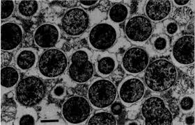 Image result for Buchnera