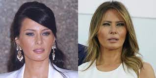 Another social media user wrote: Melania Trump Denies Plastic Surgery Breasts Before And After