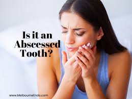 Associated Endodontists of Melbourne, Dr. Paul A. Scott, DDS, MS