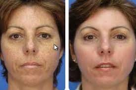 If you're planning a cosmetic surgical procedure, visit statesville's dr. Evole Mediclinic
