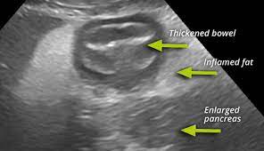 Pancreatitis In Dogs