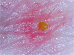 Image result for Trombicula autumnalis