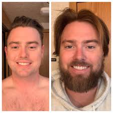 A few months ago I posted my 2 month progress pics... here I am at 5  months! Absolutely love my beard and hair : r/beards