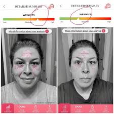 Retinol 0.3 for smooth face skin