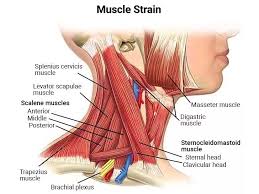 Image result for Neck Pain