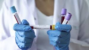 Mulai Hari Ini Rapid Swab Test Covid 19 Gratis Bagi Warga Ntt Okezone News