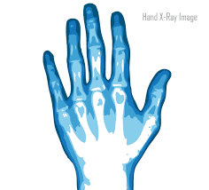Free Vector X Ray Hand Image Vector Free Hand Images Free Vector Art