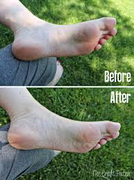 Not having to wear socks. Listerine Foot Soak The Craft Patch