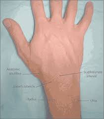 A Clinical Approach To Diagnosing Wrist Pain American Family Physician