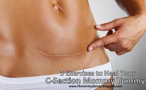 Diary Of A Fit Mommy 5 Exercises To Heal Your C Section Mommy Tummy Mommy Workout Post Partum Workout C Section Workout