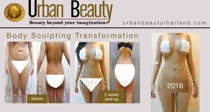 Pin On Affordable But Offers Incredible Results Hair Restoration Surgery Thailand