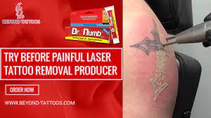 Laser Removal Numbing Cream Laser Tattoo Removal Laser Tattoo Tattoo Removal