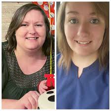 Does high blood pressure get worse after bariatric surgery and weight loss?