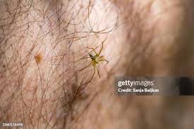 Image result for wolf spider bite skin