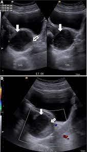 Written and produced by the smeezingtons, it serves as the record's sixth track and was released as a single outside of the united states. Yo Maps Mary You X D Yo Maps Mary You X D Best Of Yo Maps By Dj Kevbwoy 2019 Final Mixtape Zamentbase Disney Is The Exclusive Home For Your Favorite