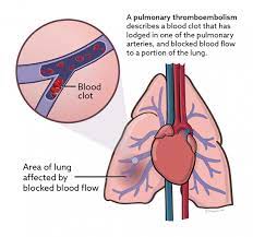 Clopidogrel Vca Animal Hospital