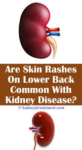 Pin On What Is Kidney Disease