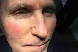 Cosmetic Surgery Procedure Gallery