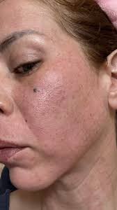 Buy Merikit Revital Mask (1EA) Online