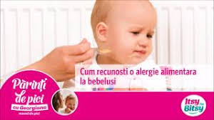 In ultimii ani, alergiile la copii au devenit un lucru obisnuit. Itsy Bitsy Cum Recunosti O Alergie Alimentara La Bebelusi Youtube