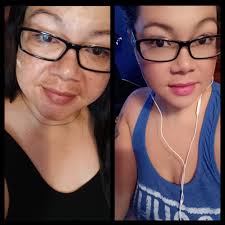 Please help!!! I am losing my confident with this hyperpigmentation under  my lips… its been morethan a year and I don't know what i can use to remove  this. Thanks