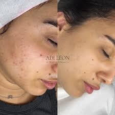 השינוי של רוז אהובתי 🫶🏽 @roz.abergel