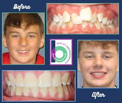 Baptist Orthodontics