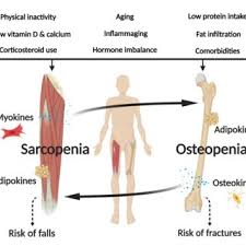 The superficial group, the deep group, and the intermediate group. Pdf Osteosarcopenia Epidemiology Diagnosis And Treatment Facts And Numbers