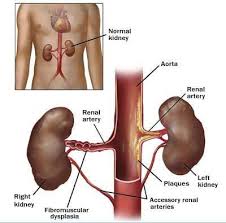 They also take waste and carbon dioxide away from the tissues. Renal Artery Doppler Sonographic Tendencies