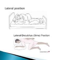 The safe airway position is often called left lateral recumbent, especially in the us. Positions Used In Nursing Patientsclients Positions Used In