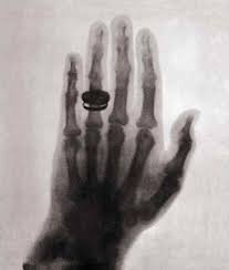 World S First X Ray 1895 Rontgen S Wife Hand Historical Photos History Science Nature Cat