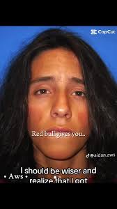 Aidan Stokes Redbulls